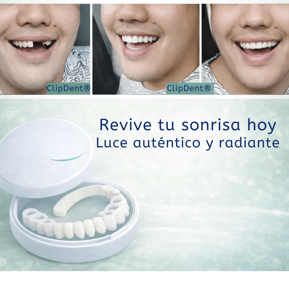 ClipDent® -  Cubre imperfecciones dentales al instante🦷
